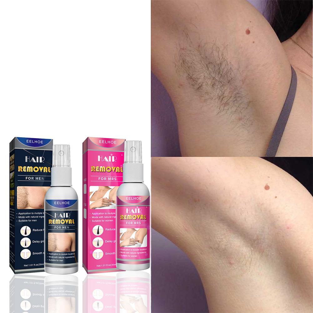 1/2 Uds. Depiladora permanente - Hair Care Women reseña y precio